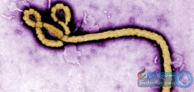 تعرف على فيروس الإيبولا